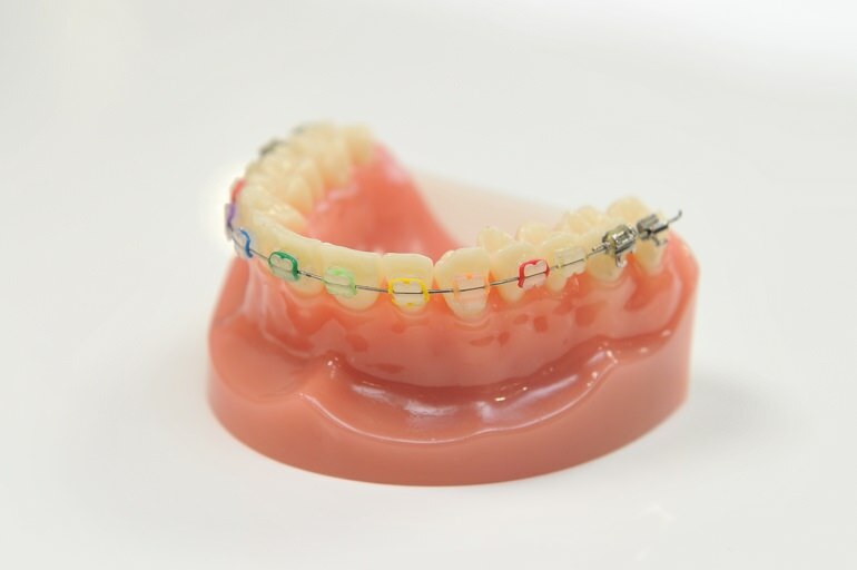 費用が高いために検討されている方へ